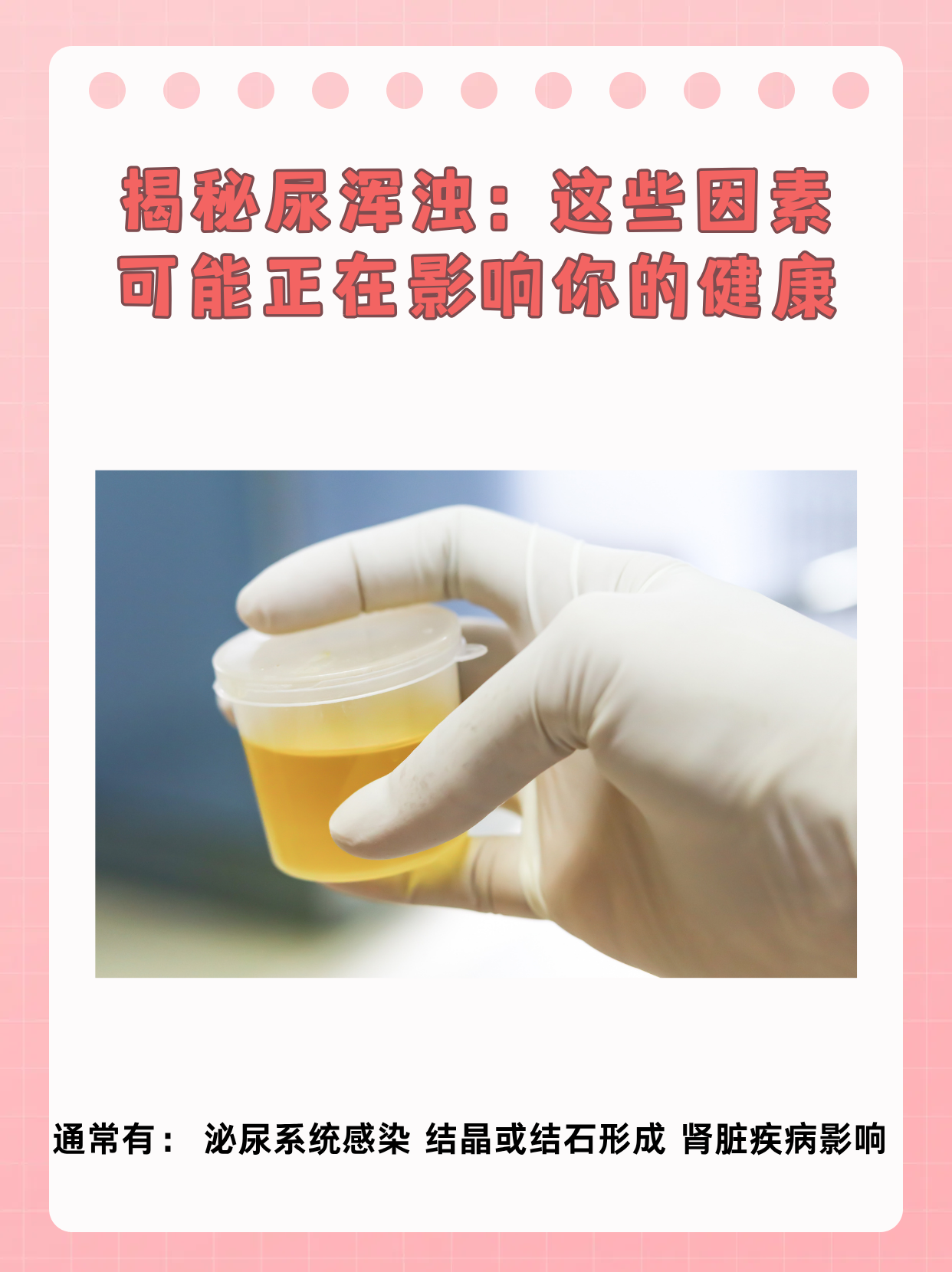 尿液浑浊是怎么回事?