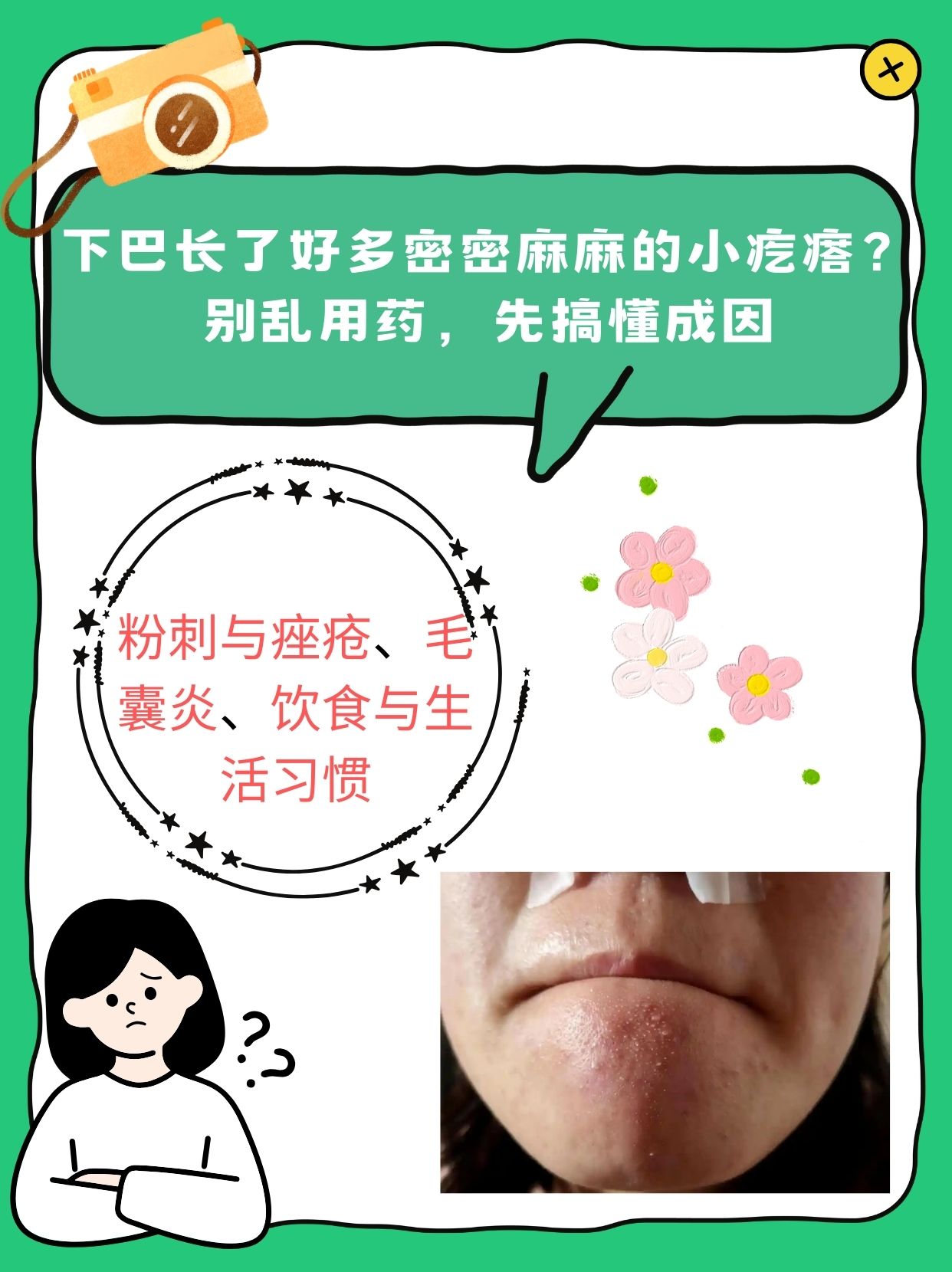 脸上长小疙瘩,怎么办?