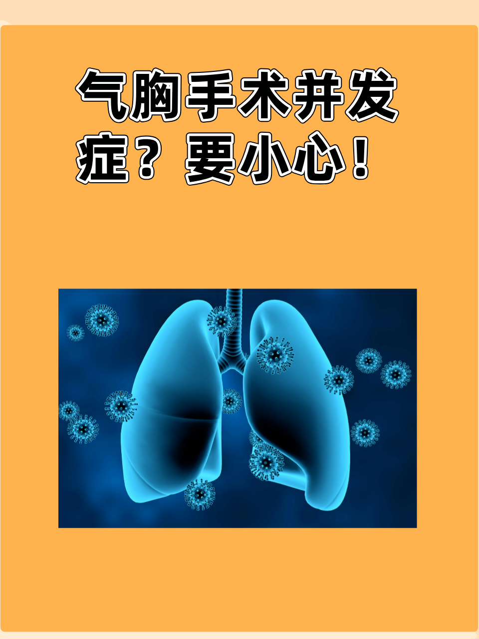 气胸很严重吗?