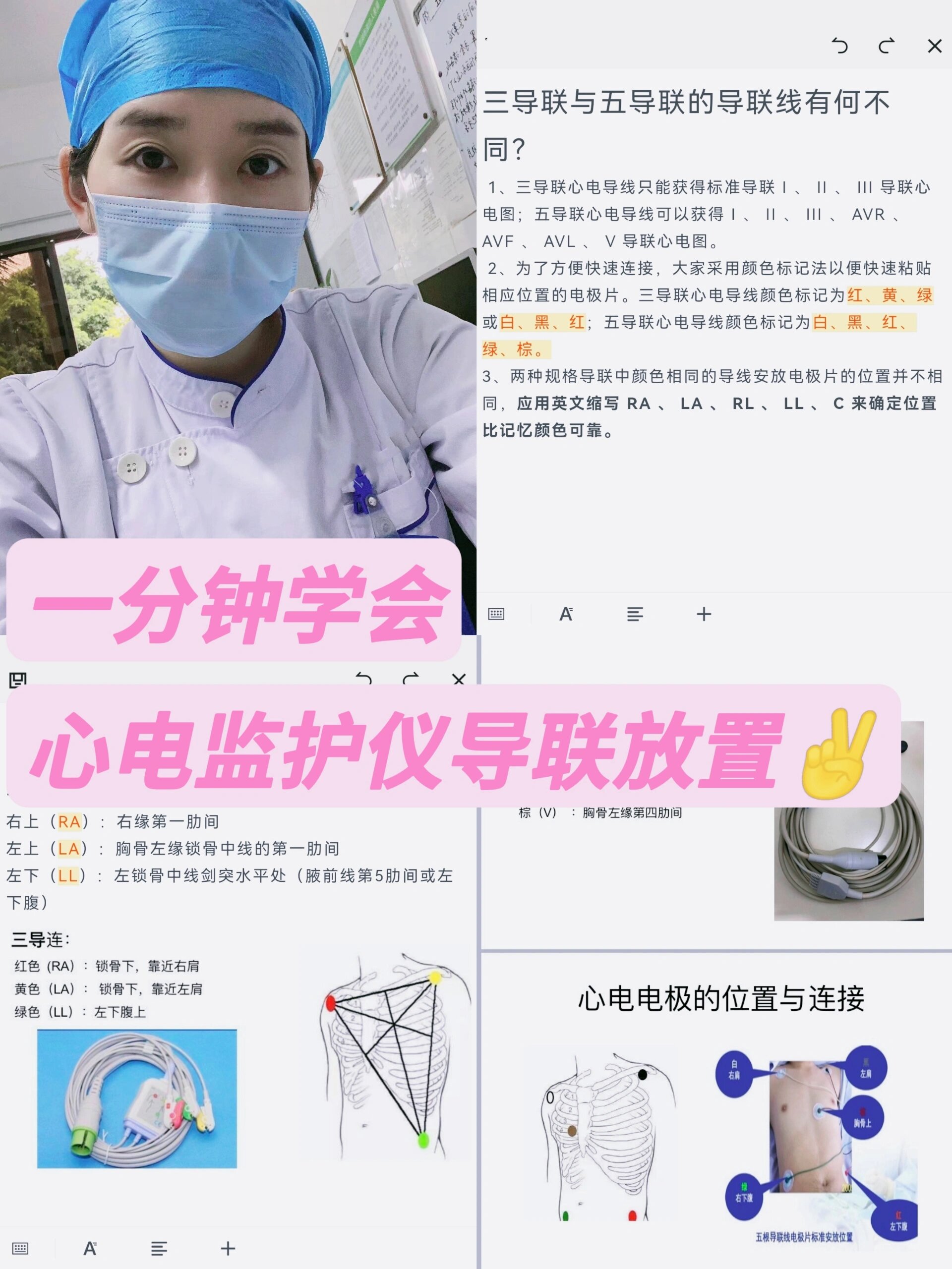 心电监护电极片的位置