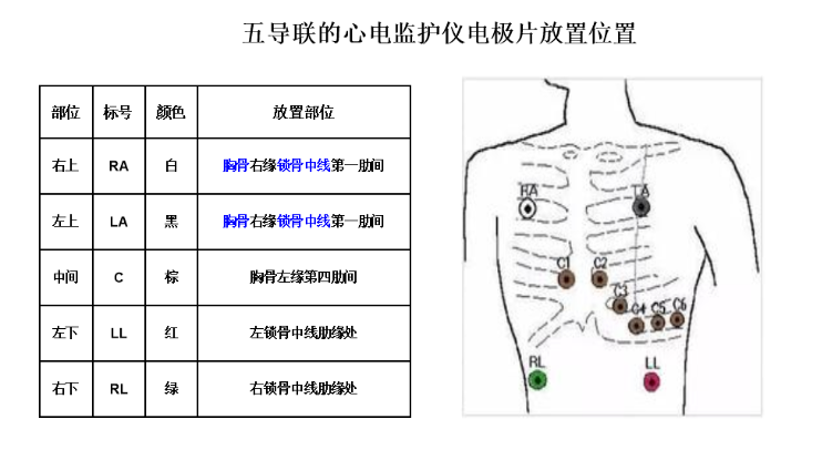 心电监护电极片的位置