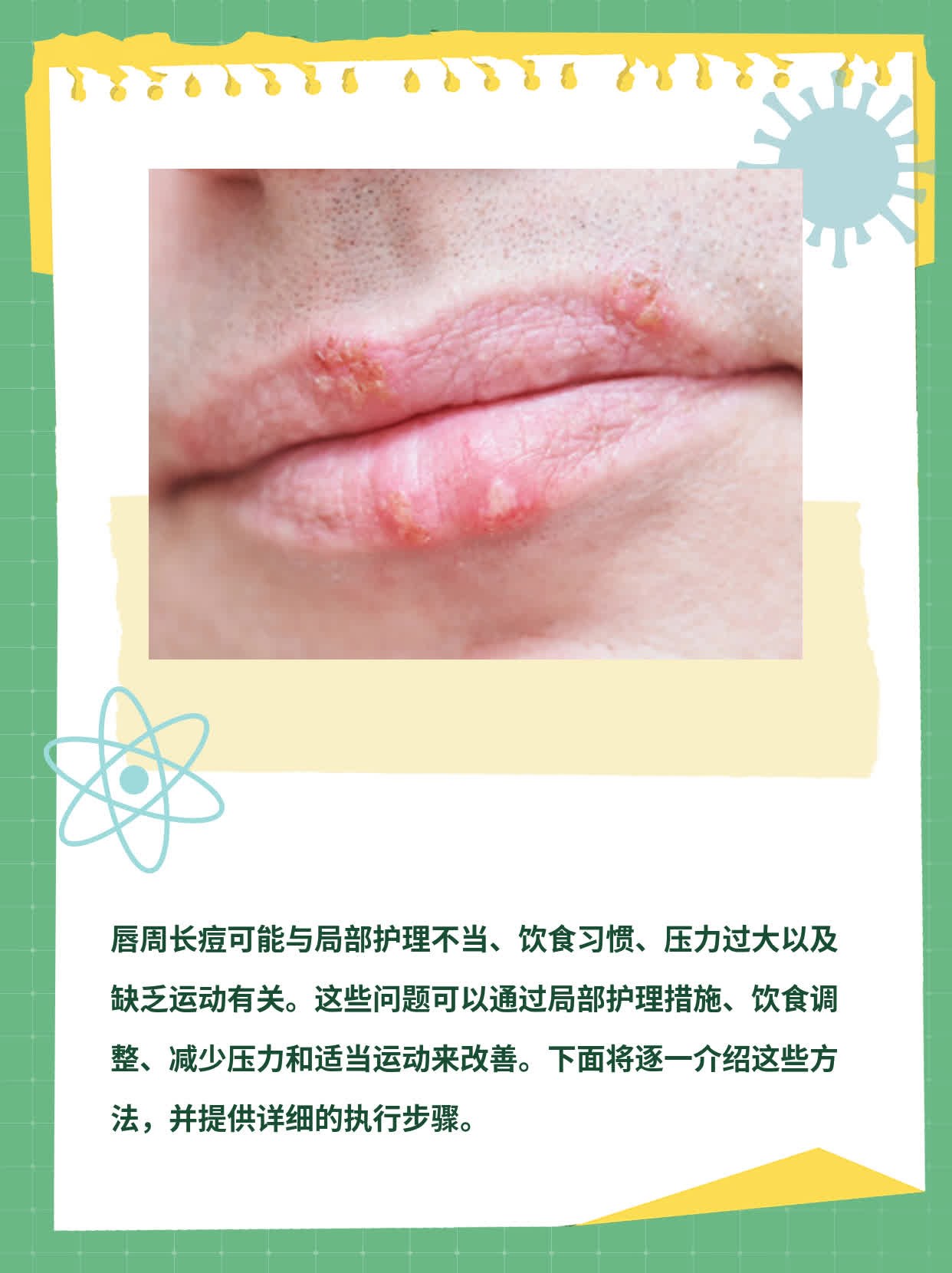 嘴唇周围红肿紧绷发痒怎么办