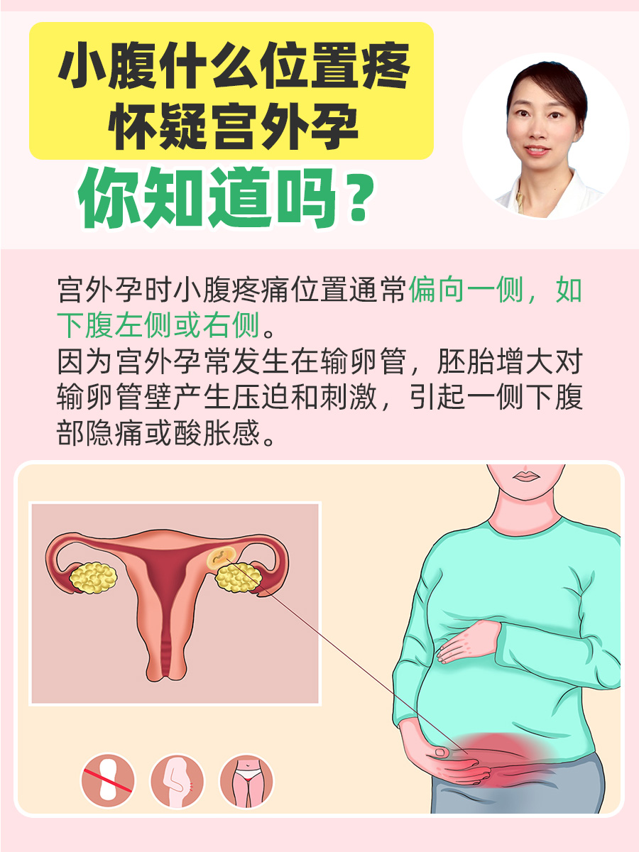 宫外孕的症状都有哪些