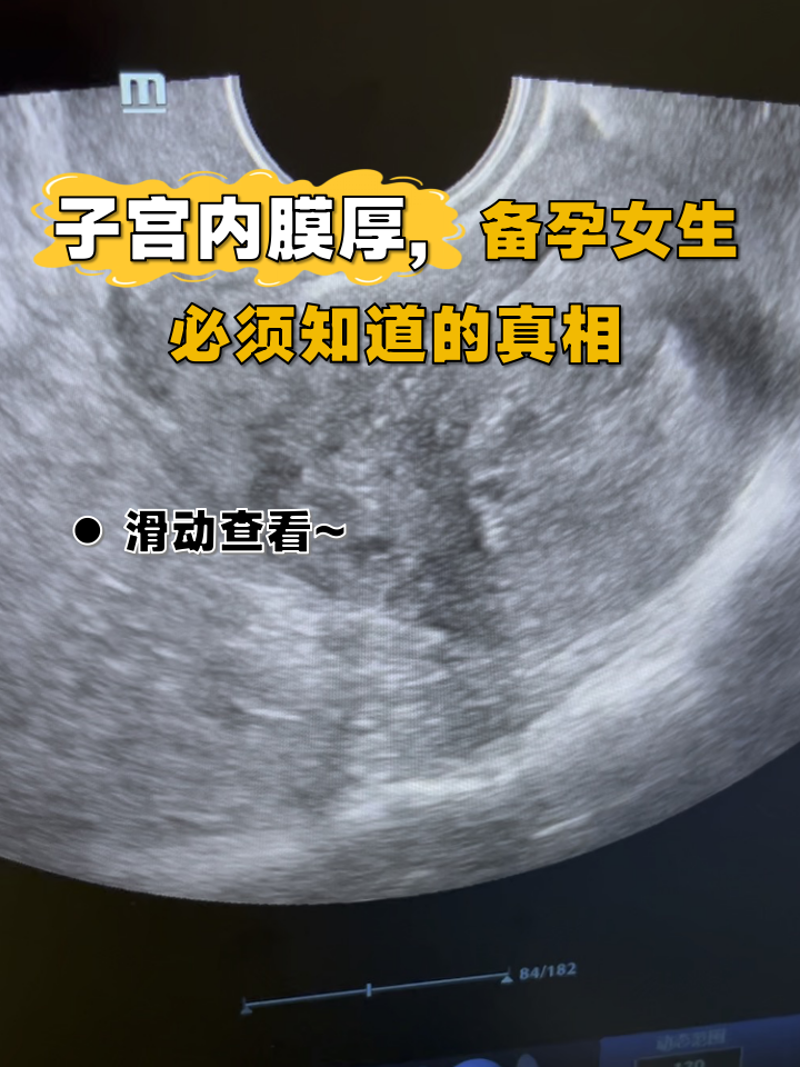 子宫内膜多厚容易癌变