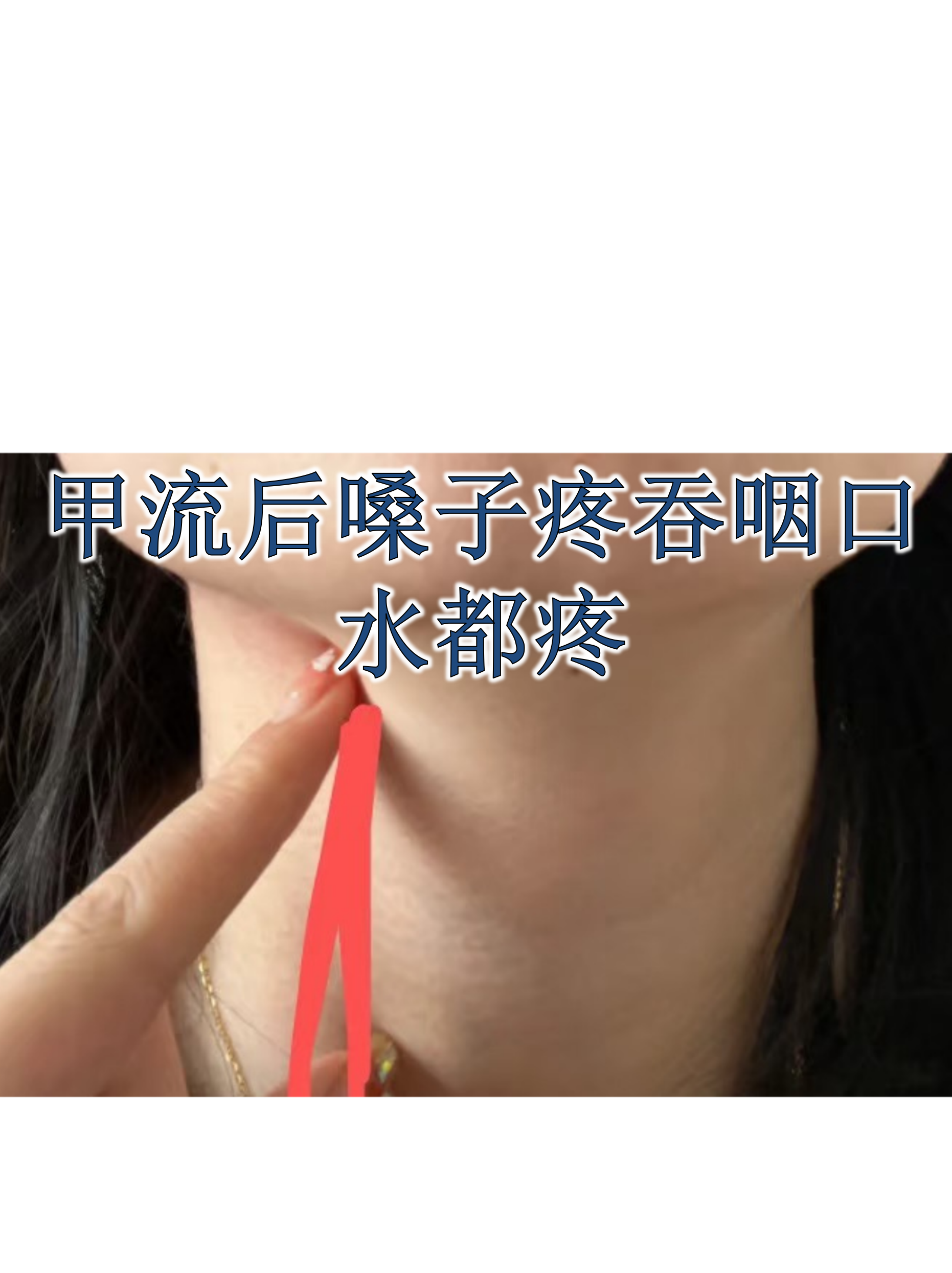 甲流的症状是什么