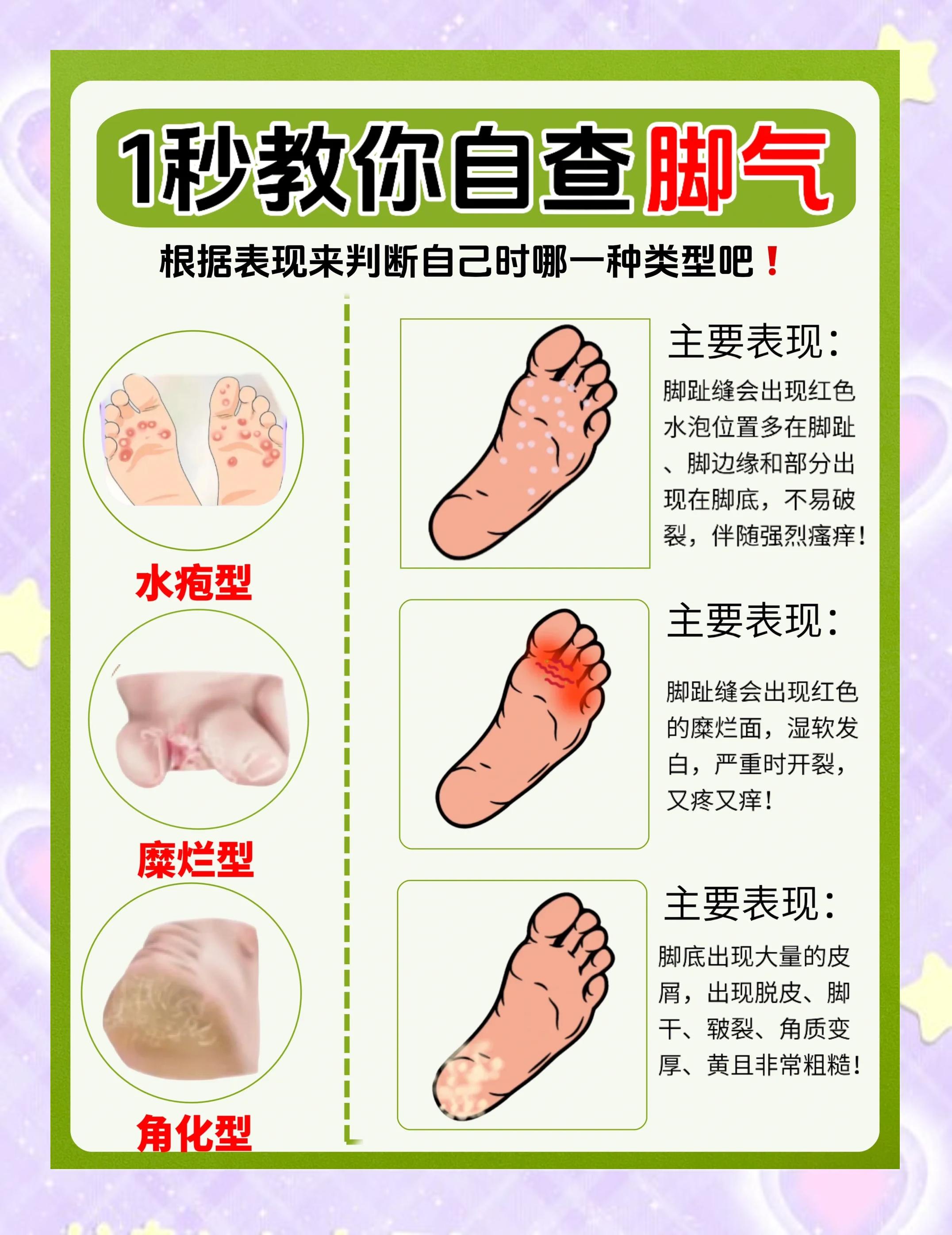 夏天脚凉是什么原因?