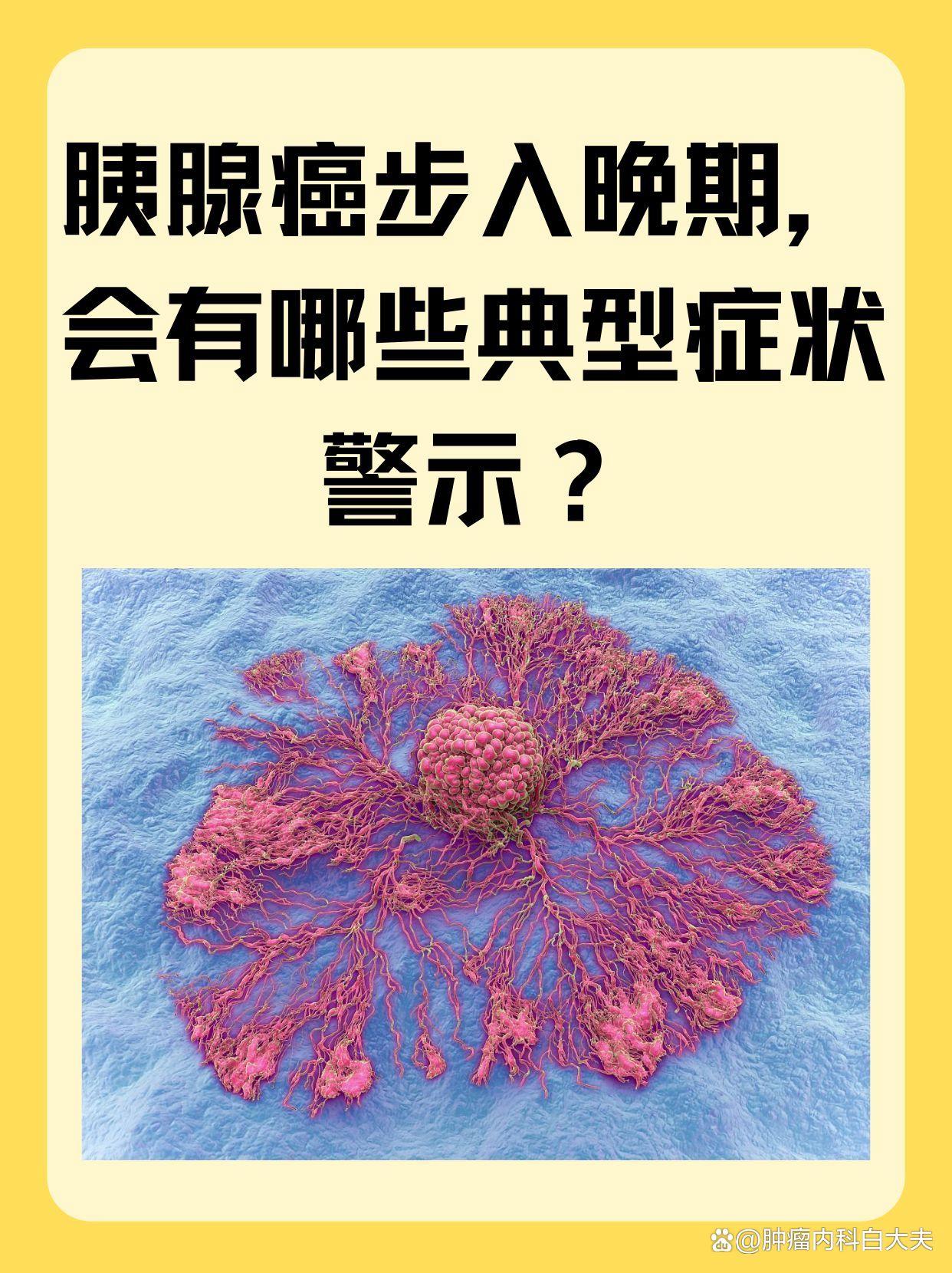 胰头癌的典型表现是什么