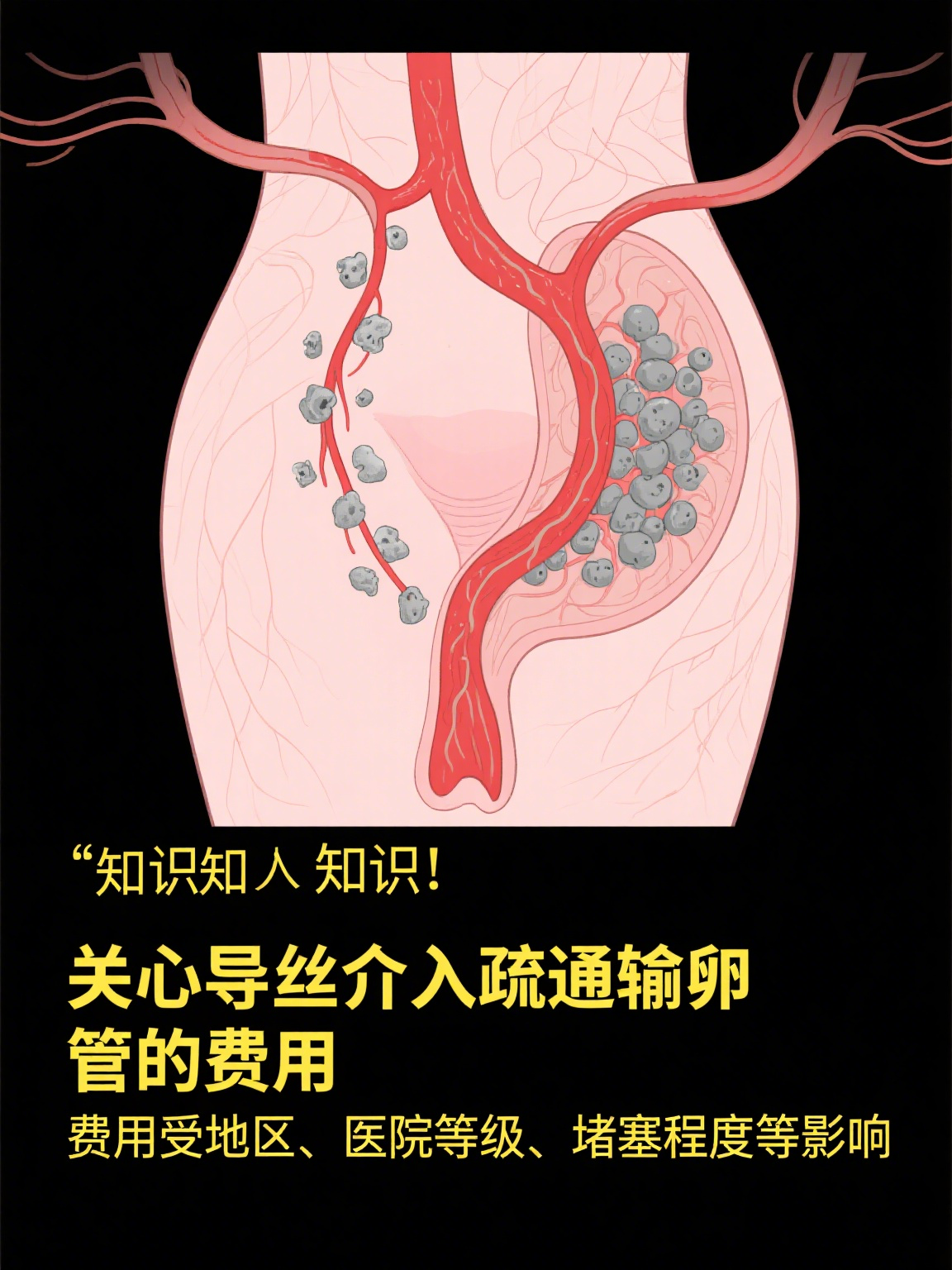 介入治疗副作用