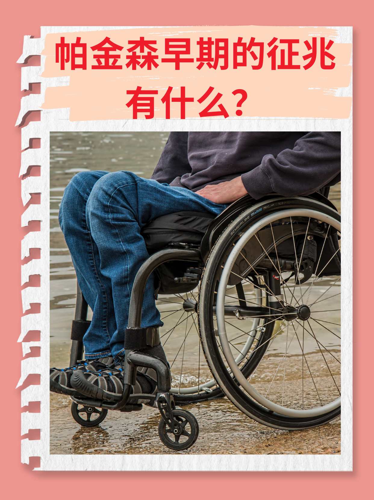 帕金森病是老年痴呆吗