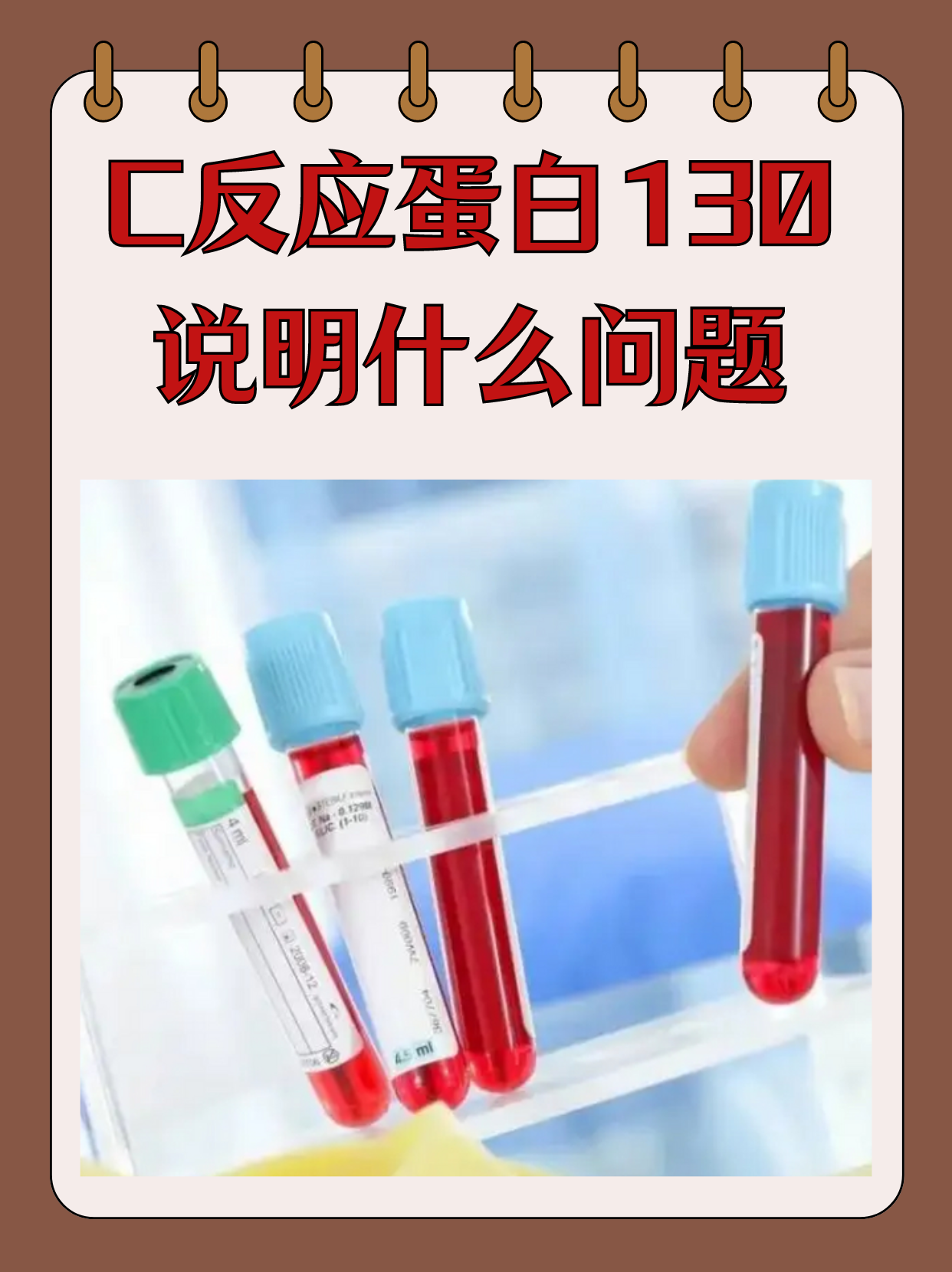 c反应蛋白测定是什么