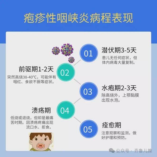 急性咽峡炎的病因