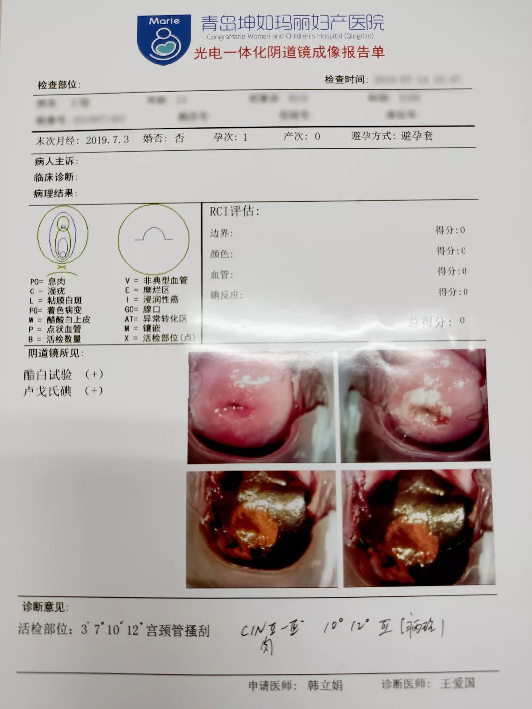 宫颈癌手术后能活多久?