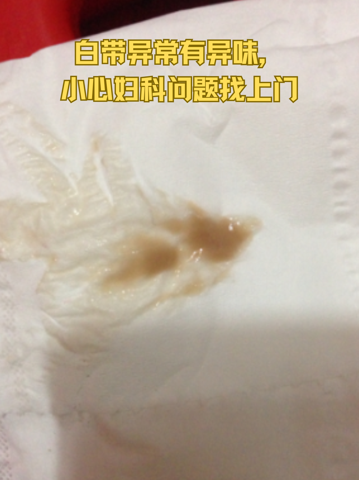 白带发黄,如图(网上找来的)