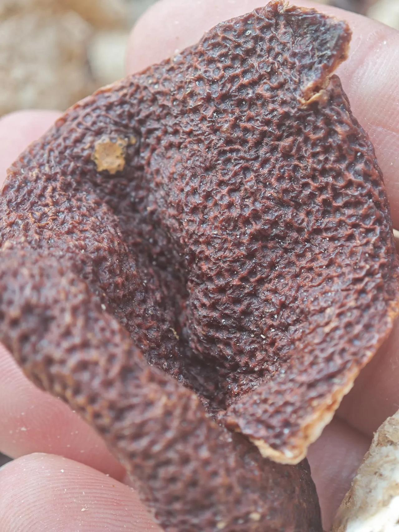 橘皮组织是什么样子