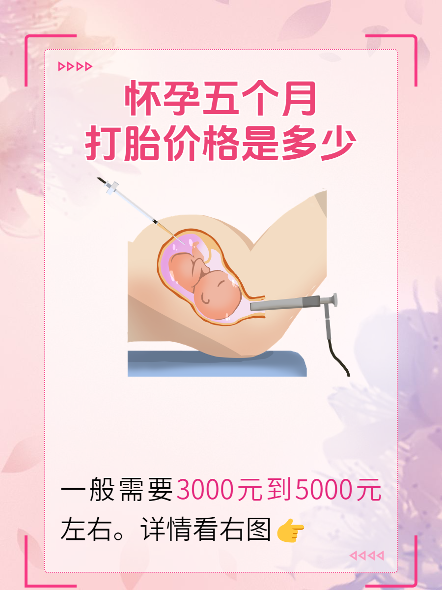 怀孕五六个月能打掉吗