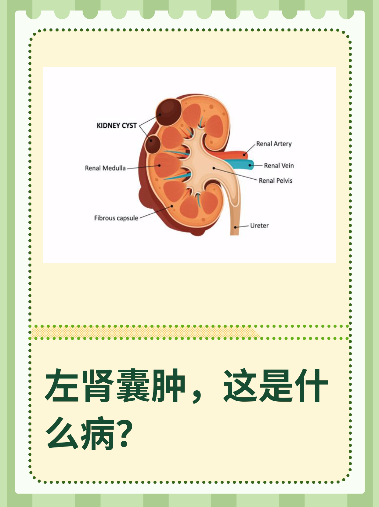肾上囊肿有危险吗