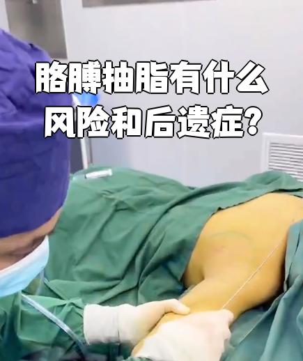 什么是吸脂手术?