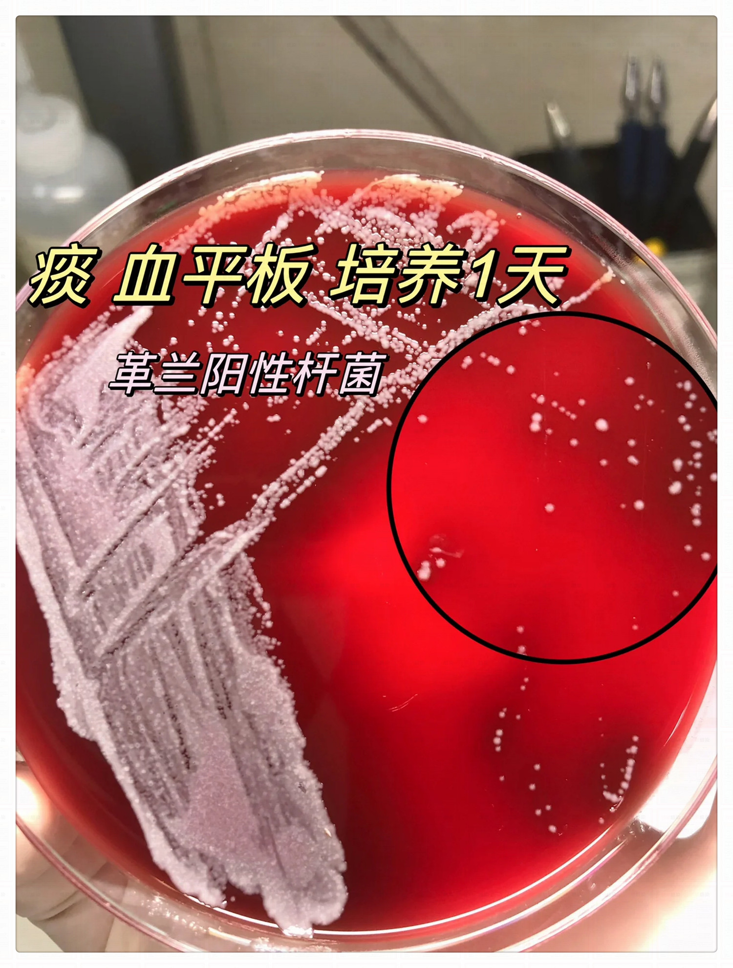 什么是革兰氏阳性菌