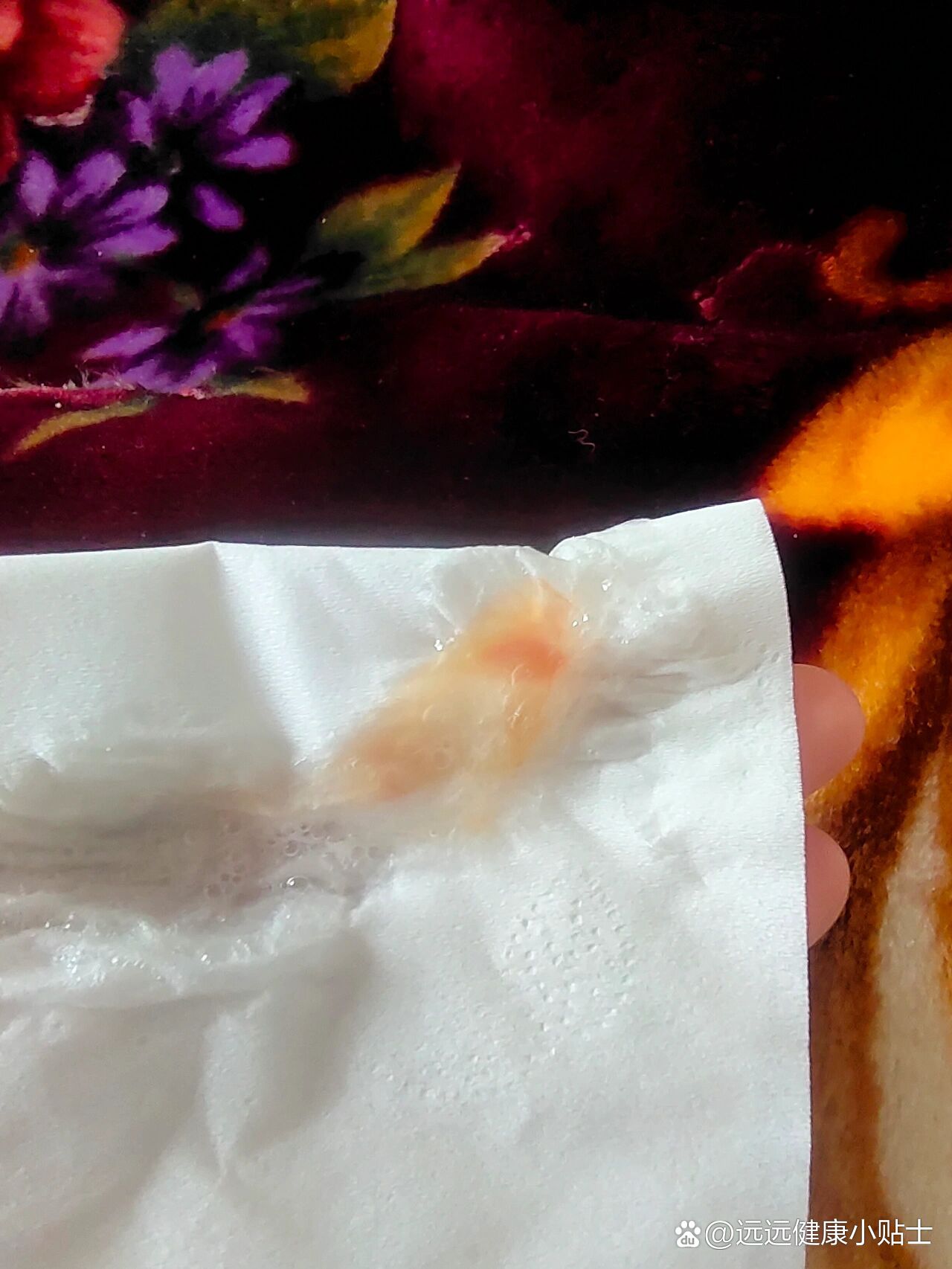 痰中带血什么症状