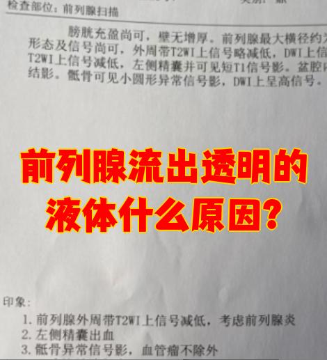 前列腺液会导致怀孕吗?