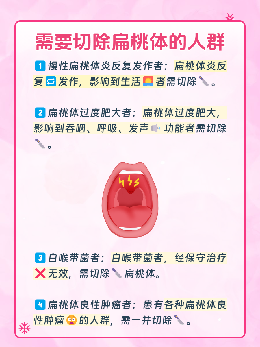 什么是扁桃体切除?