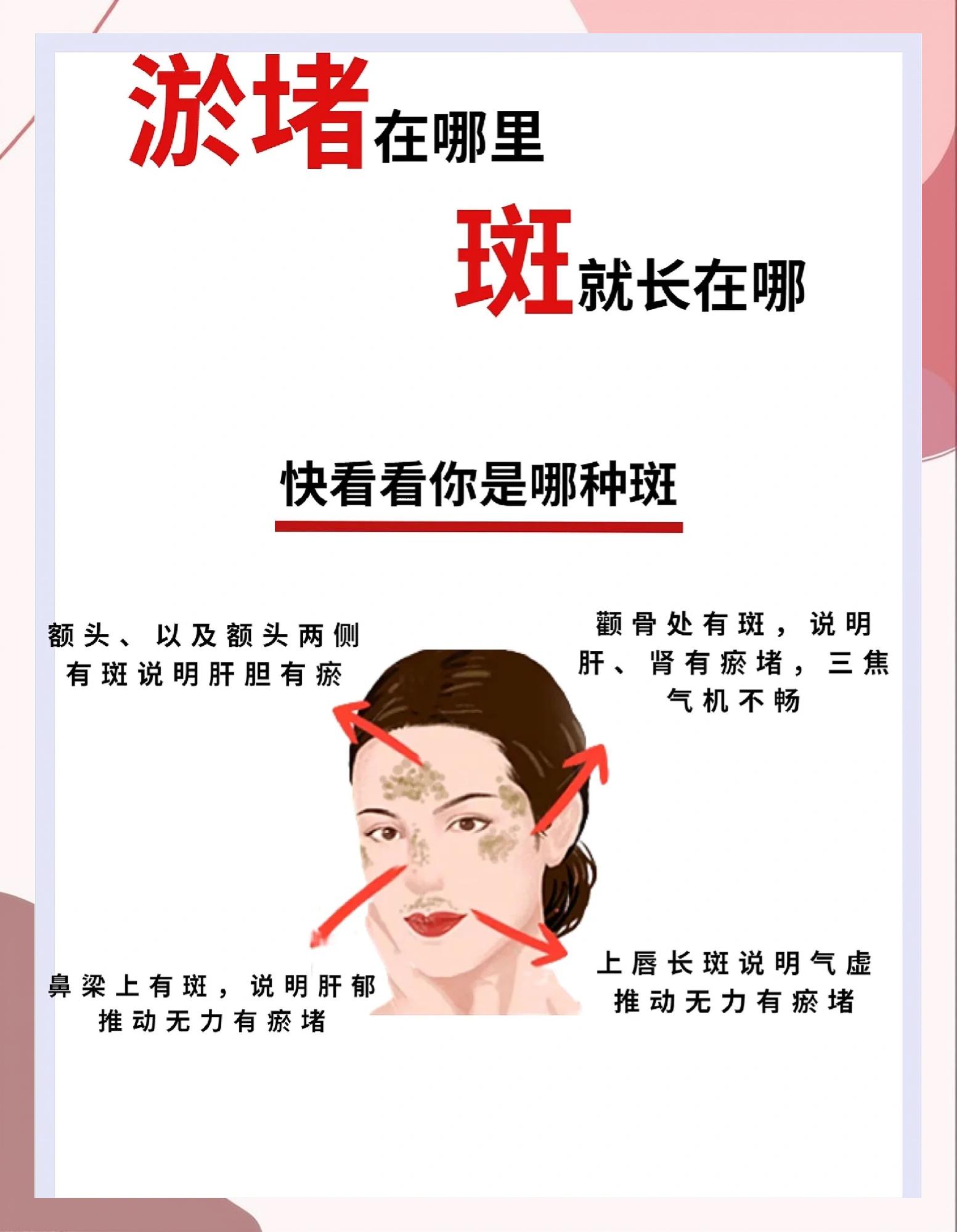 脸上长有雀斑是什么原因引起的?