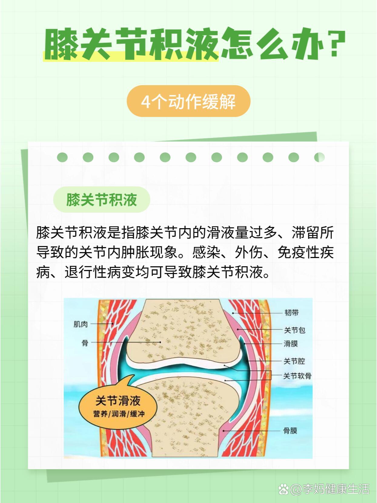膝关节积液要热敷还是冷敷