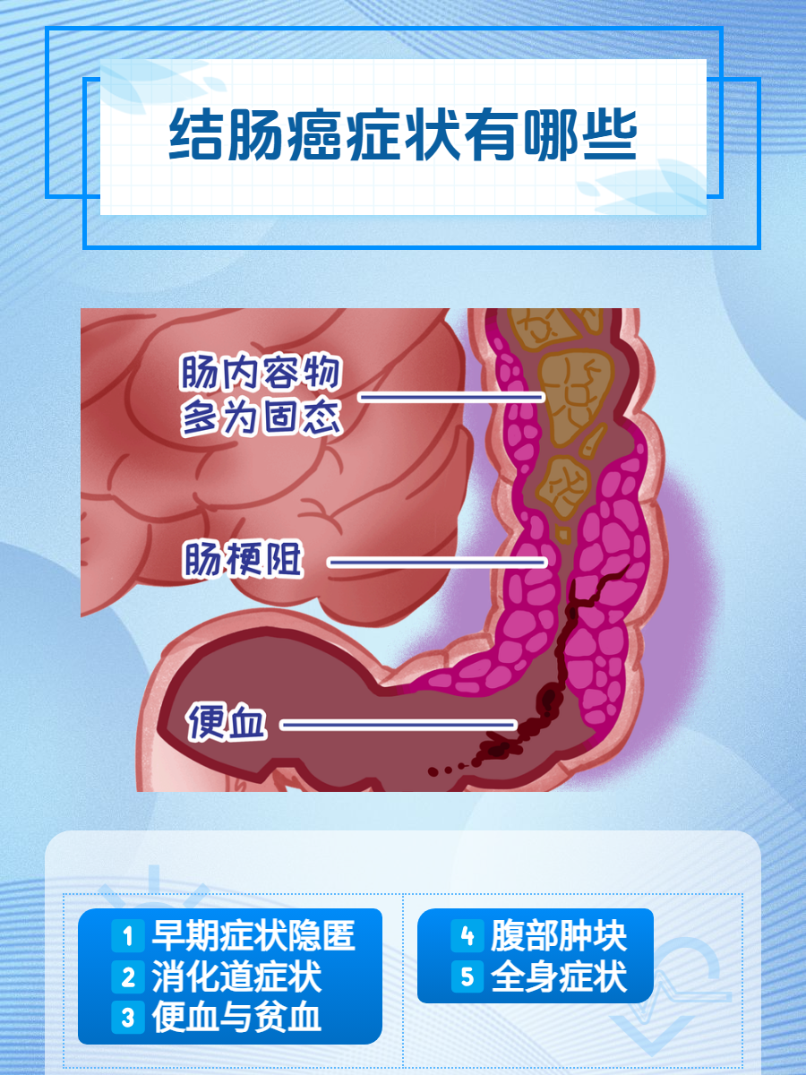 肠癌的晚期症状有哪些?