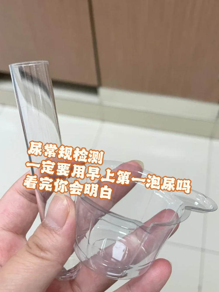 一般尿道常规检查要多少钱