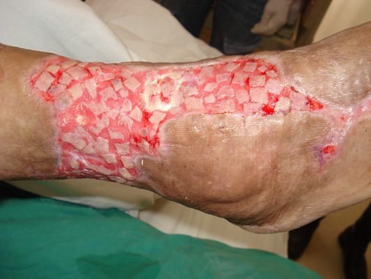 败血症的症状有哪些?