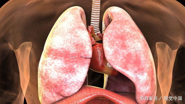 肺癌不手术初期能活多久..