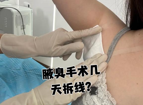 腋臭手术后多久能恢复?