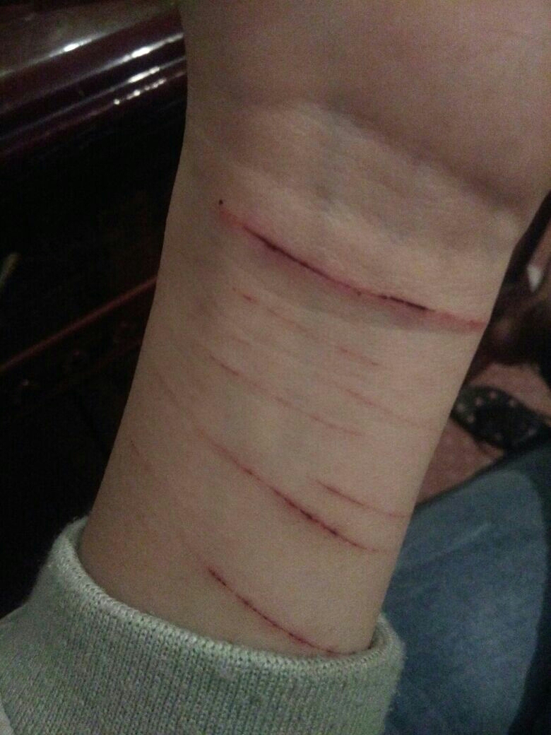 割腕流血多长时间会死