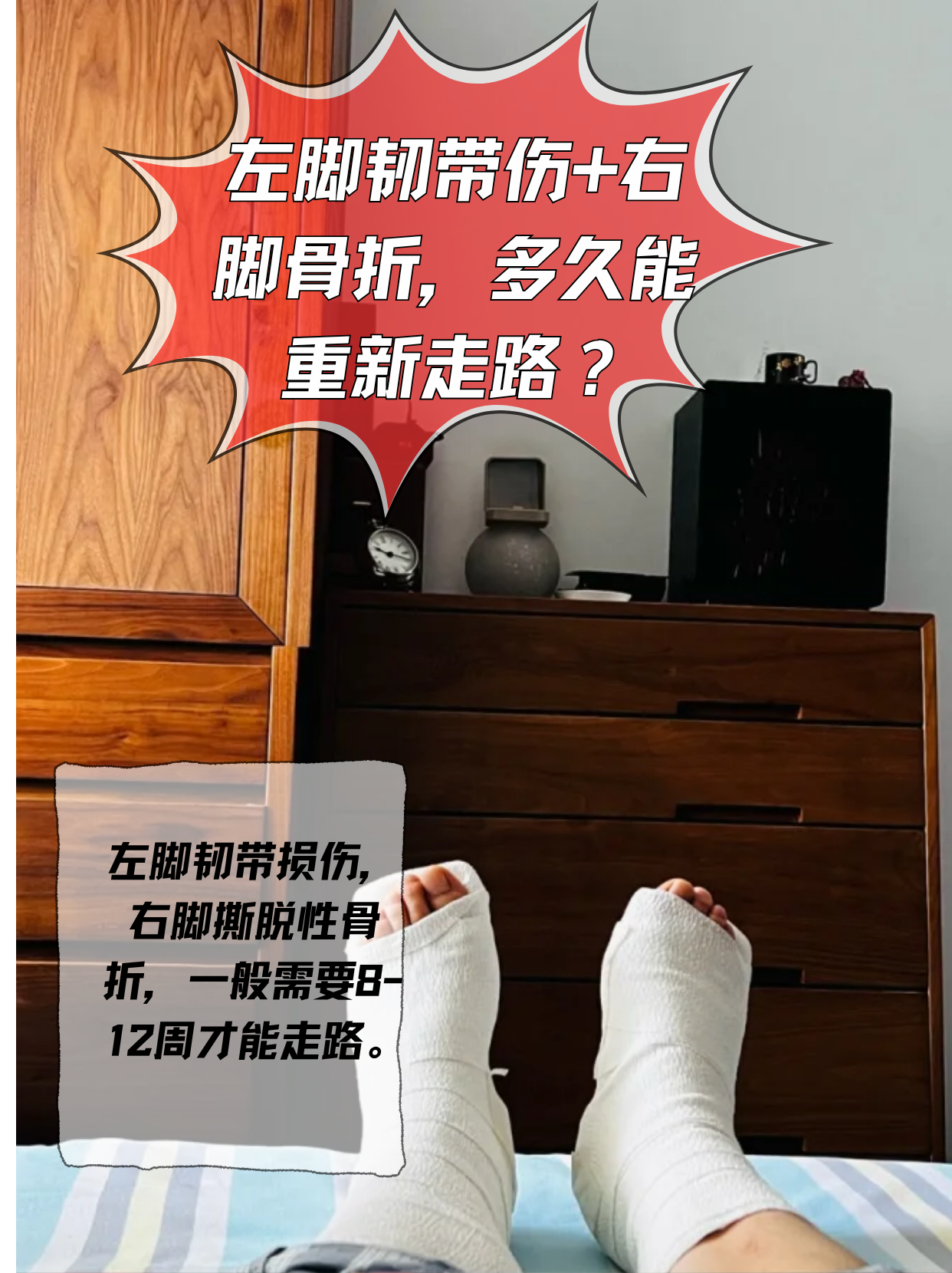 脚崴了,如何判断是否骨折