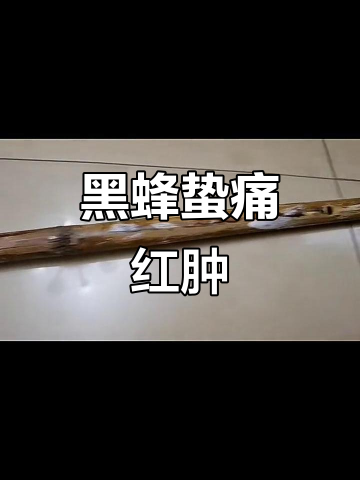 手指被蜜蜂蛰肿了怎么消肿
