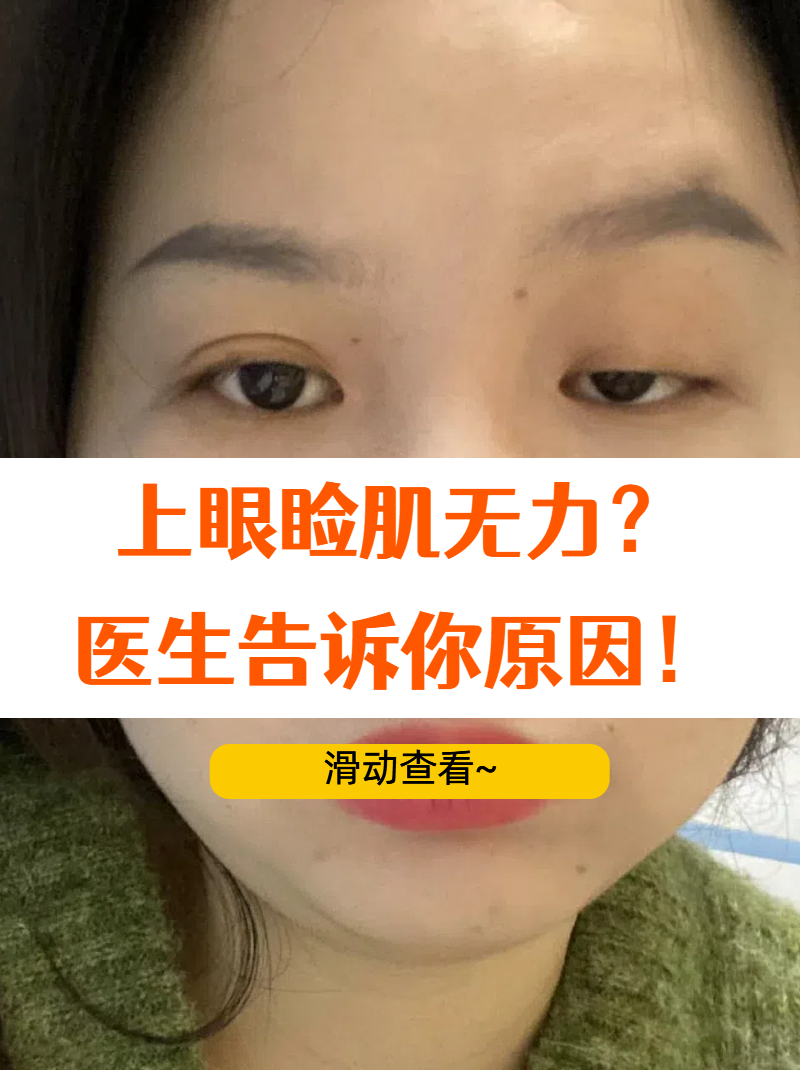 肌无力是什么病