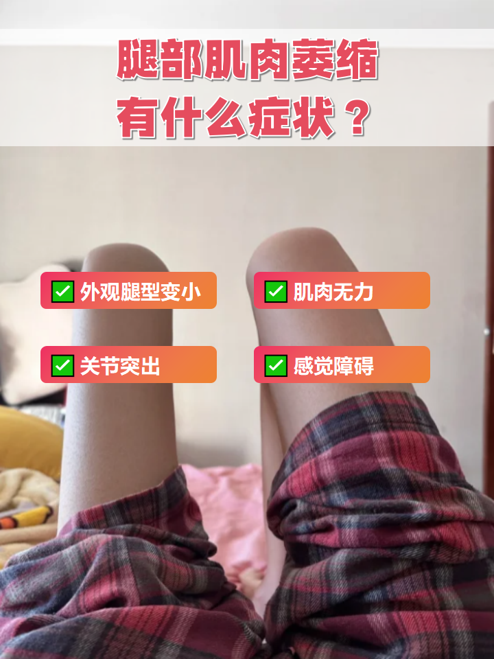 肌无力是什么病