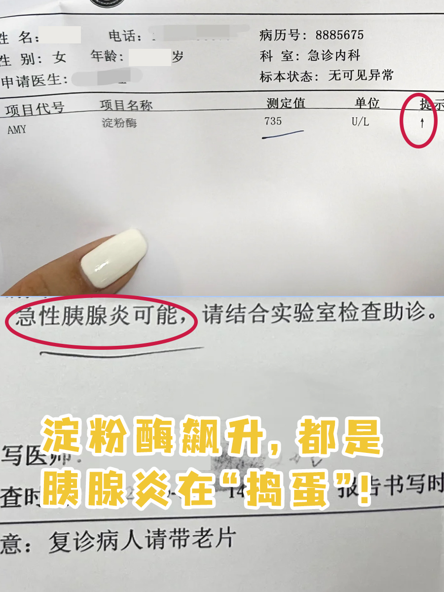 尿淀粉酶高是什么原因