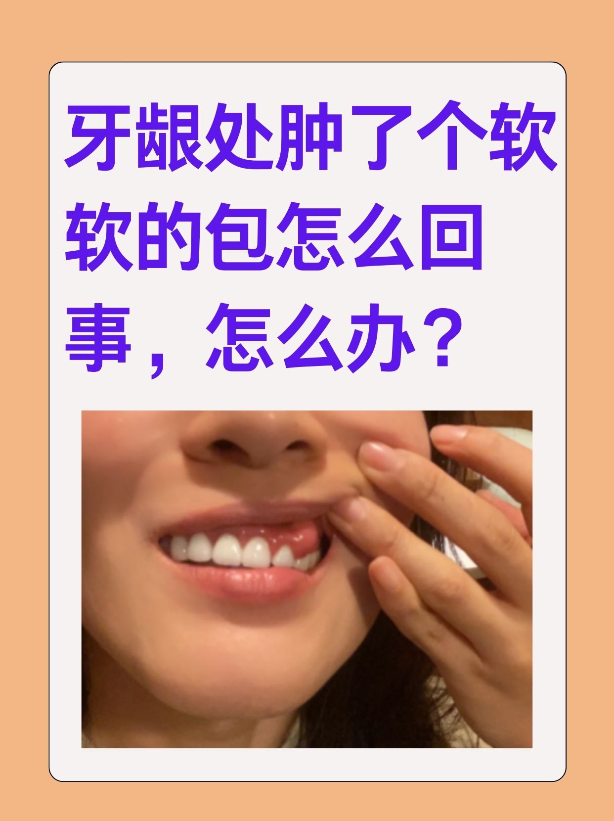 一碰就痛的牙齿该怎么办