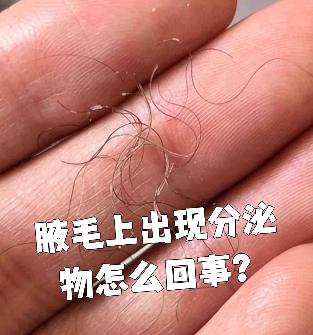 腋毛上有白色的东西怎么去除