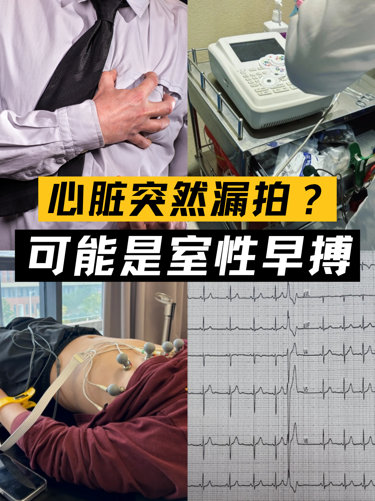 偶发室性早搏怎么回事