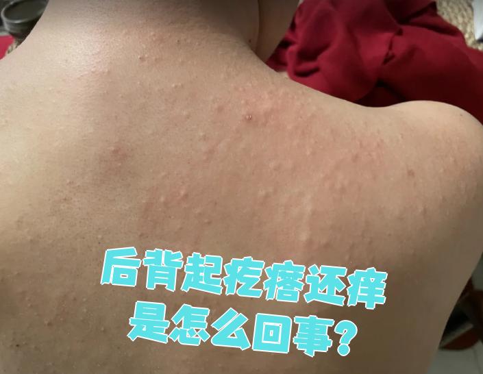 后背起疙瘩