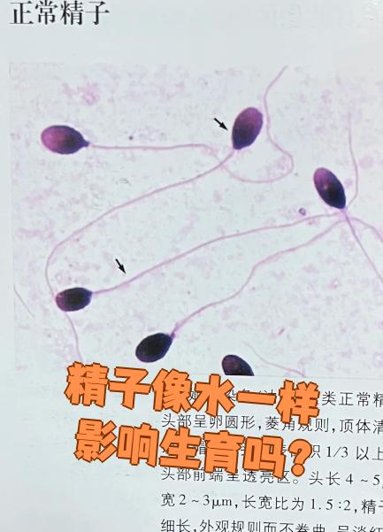 精子像水一样会怀孕吗