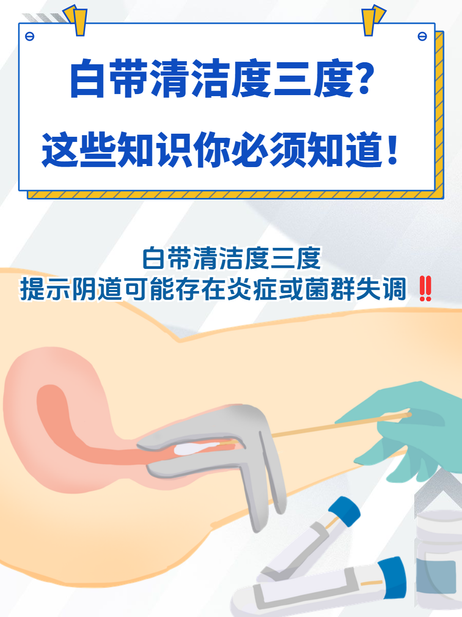 白带常规清洁度是什么意思