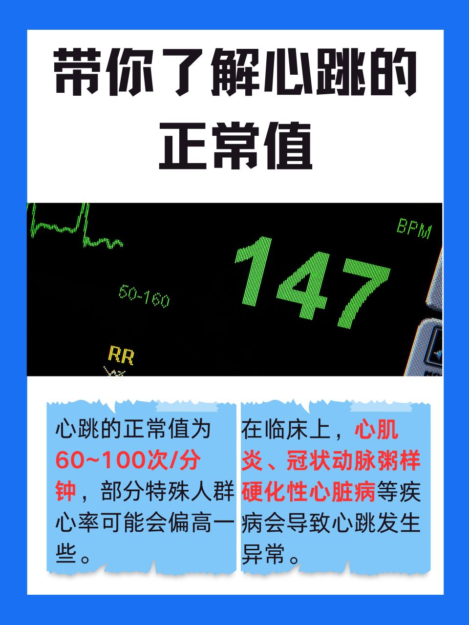 脉搏一分钟跳动多少下是正常的