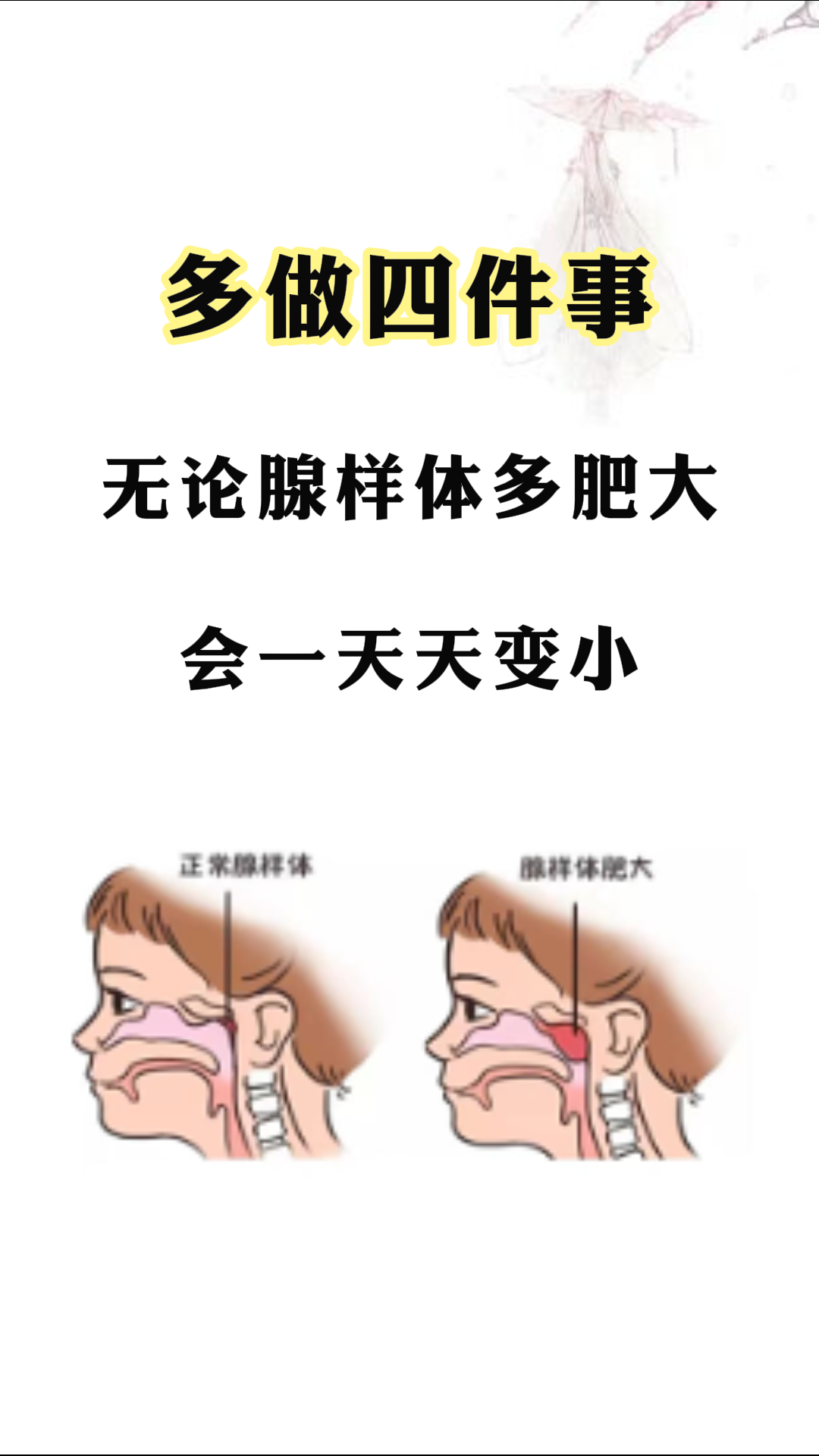 腺样体肥大手术有什后遗症