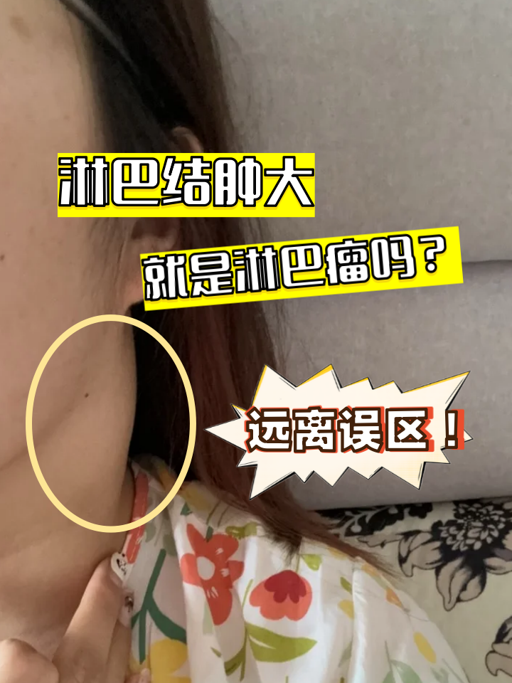 甲状腺癌转移到淋巴结严重吗