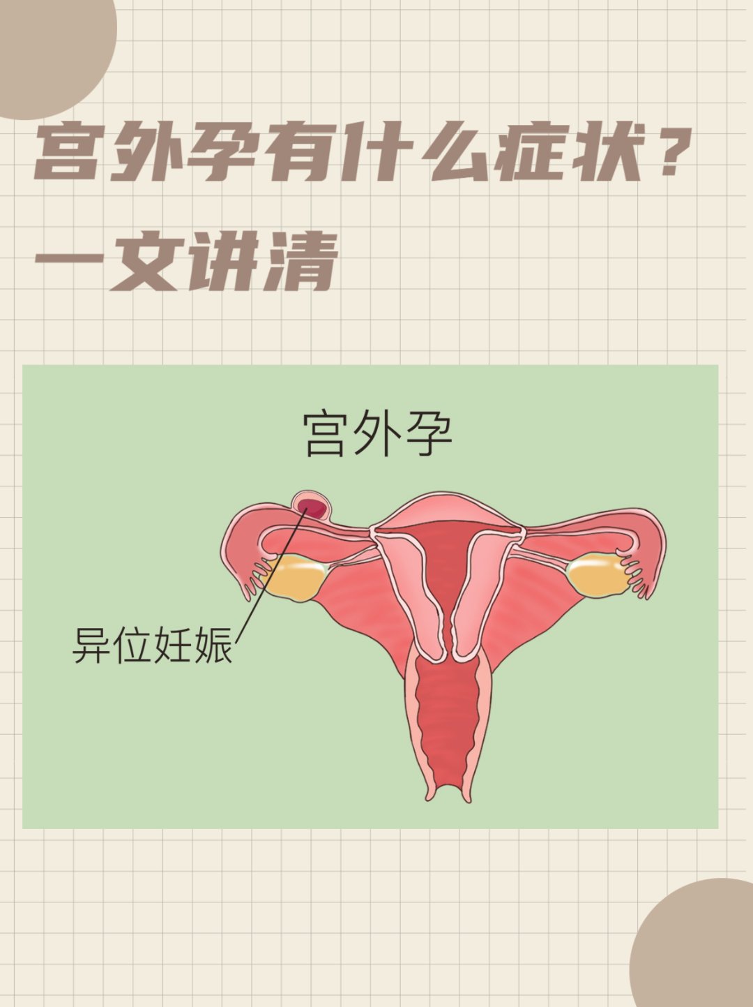 宫外孕可以生下来吗