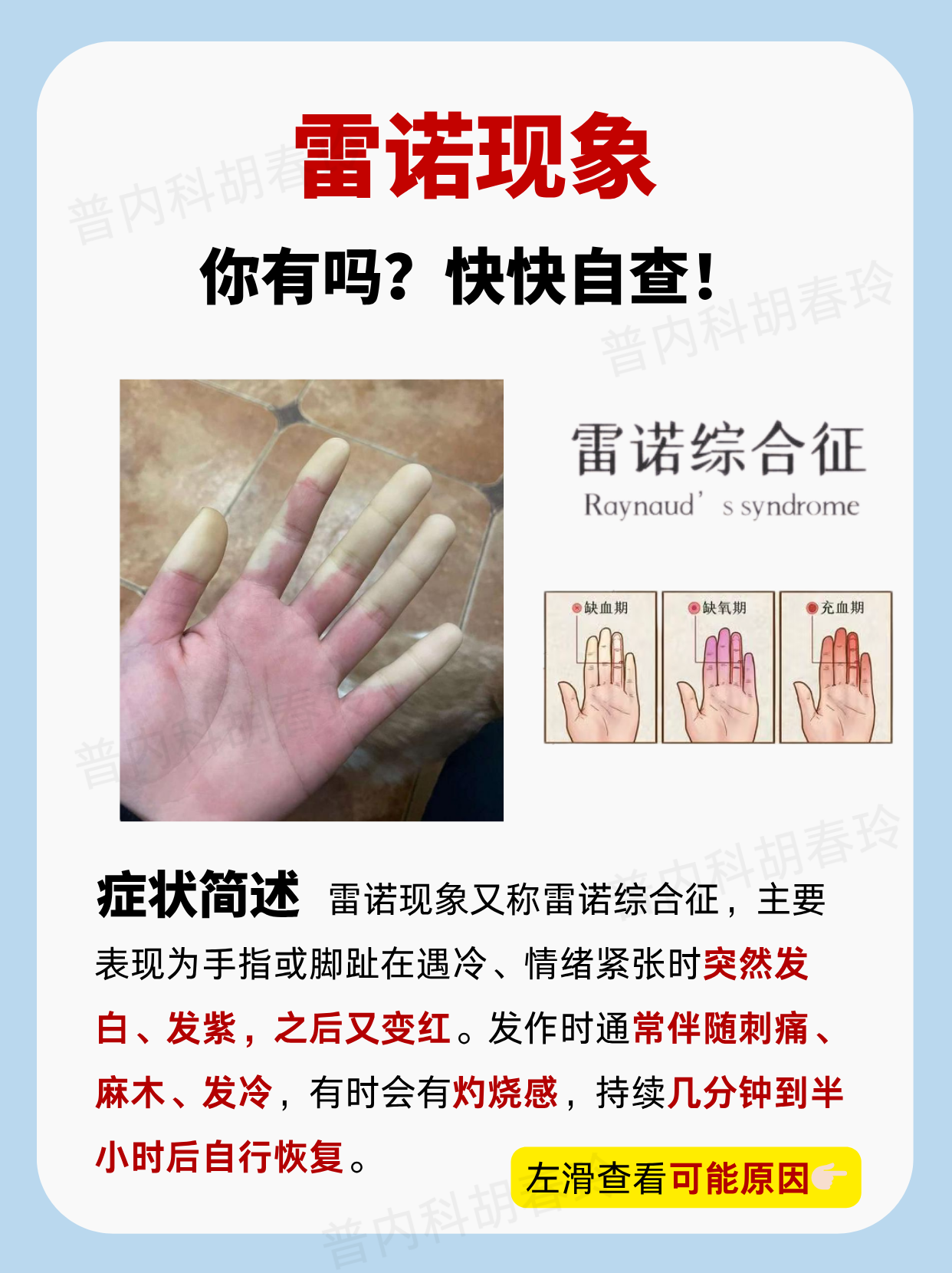 什么是闭锁综合征