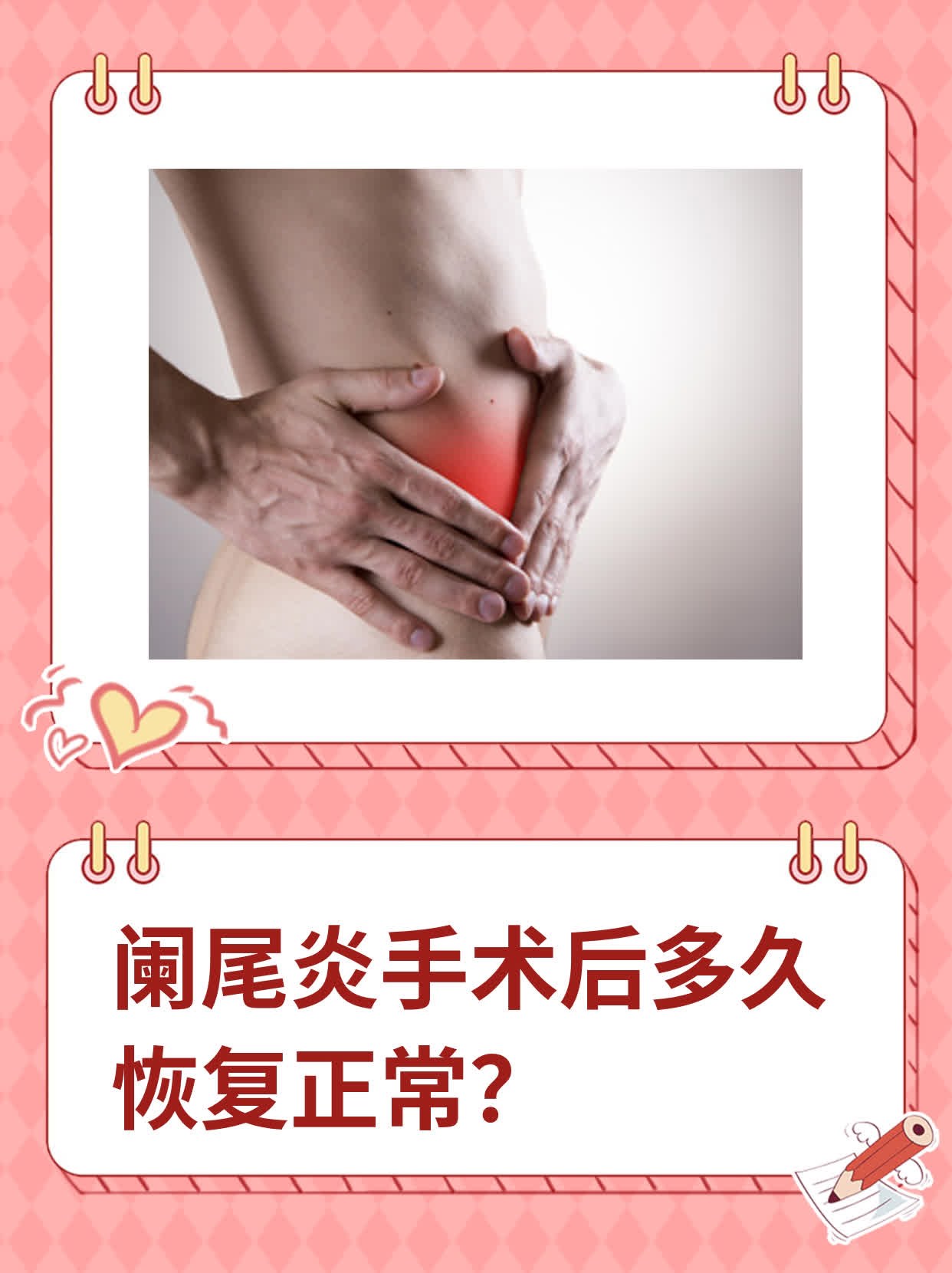 阑尾炎保守治疗需要几天